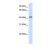 Western Blot: Beta Hydroxysteroid Dehydrogenase Antibody [NBP1-59531] - This Anti-HSD3B2 antibody was used in Western Blot of 293T tissue lysate at a concentration of 1ug/ml.